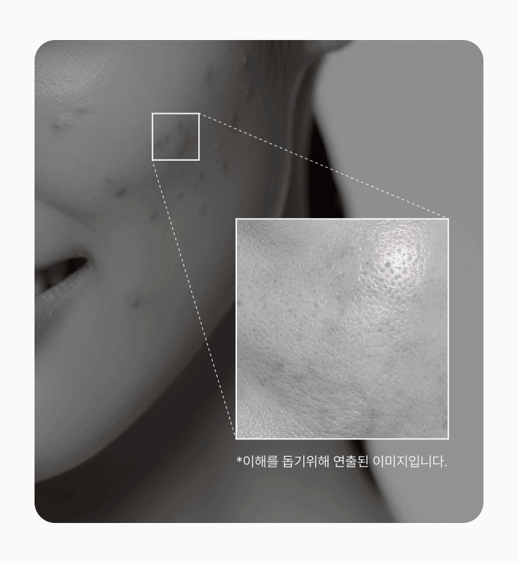 Skin Analysis Process